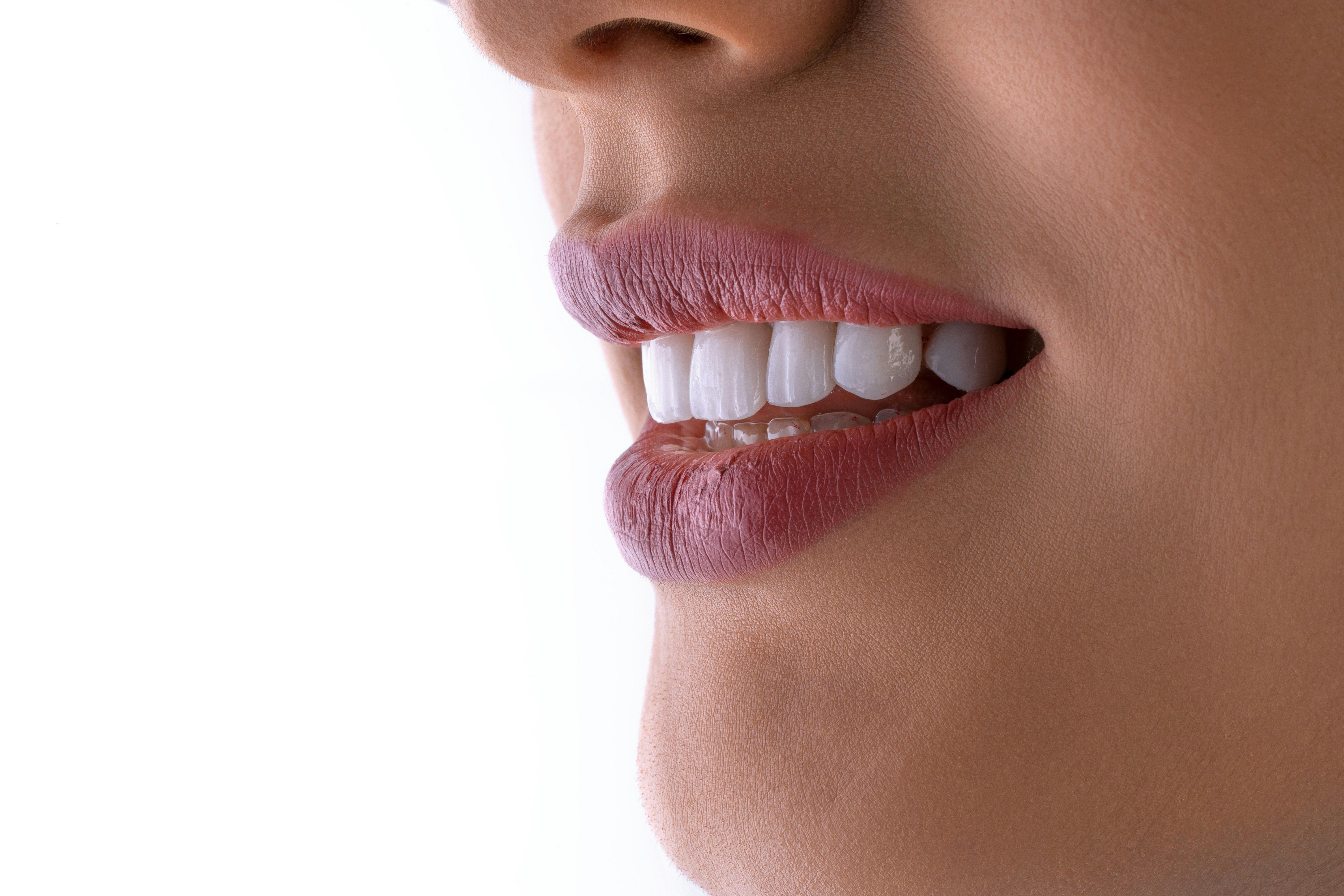 A beautiful smile.